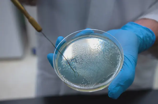 Placa de Petri con la bacteria salmonella