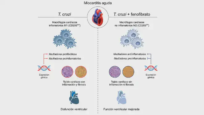 “Fenofibrate (on the right) changes the profile of cardiac macrophages, reduces inflammation and fibrosis, and improves ventricular function in an experimental model of Chagas disease.”