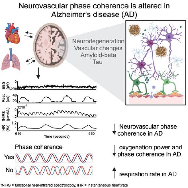 Paper’s graphical abstract. Credit: Aneta Stefanovska et al.