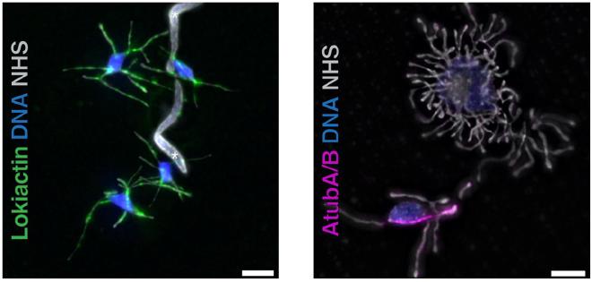 Expansion microscopy, a novel light microscopy technique, shows the cytoskeleton of Asgard archaea: Actin filaments (green) and, in the right-hand image, a microtubule (violet)  (Image credit: Wollweber F, et al. Cell, 2025)