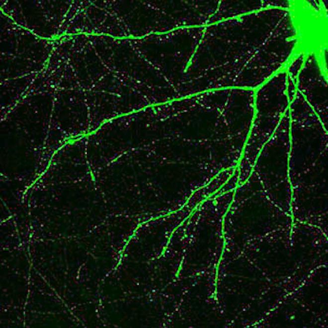Image taken with a fluorescence microscope showing hippocampal neurons cultured in vitro that express GFP, as well as their dendrites, which have many dendritic spines. Image Credit: Patrick Pla