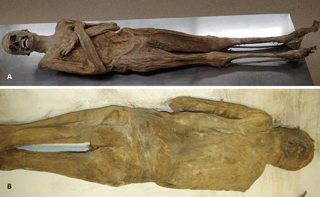 External appearance of the mummy from the ventral (A) and dorsal side (B) showing a completely intact body wall. Credit: Andreas Nerlich.