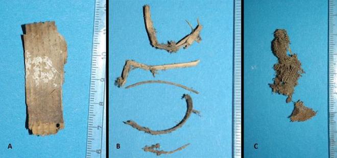 Analysis of the packing material obtained during the partial autopsy of the abdomen revelaed A: Typical wood chip. B: Twigs of various plants. C: Small fragment of a simple fabric made of hemp or flax. Image: Andreas Nerlich.