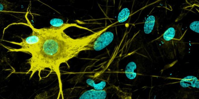 Un tipo de célula nerviosa (amarillo) de varios cientos que los investigadores de ETH han cultivado a partir de células madre en el laboratorio (imagen de microscopía). (Crédito de la imagen: Hsiu-Chuan Lin y Malgorzata Santel / ETH Zurich)
