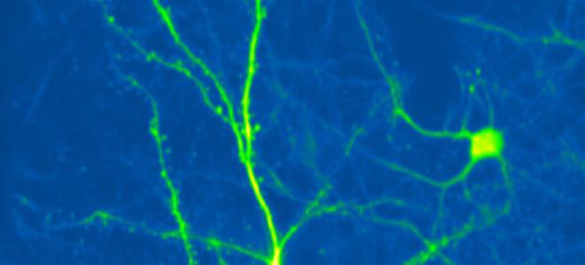 Cortical neuron expressing green fluorescent protein, imaged in the living mouse brain using two-photon microscopy. Copyright Ronan Chéreau