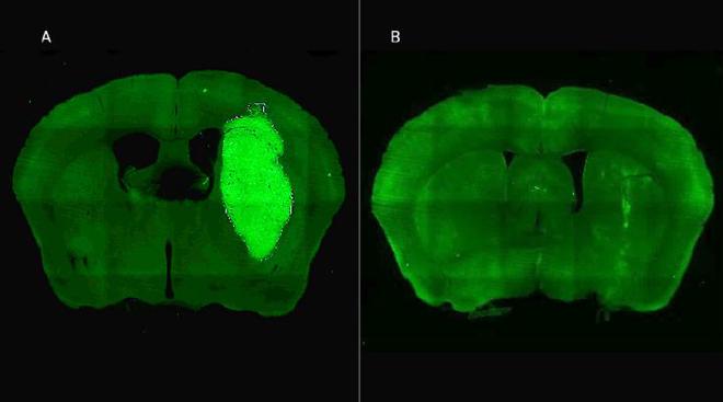 A) The brain tumor is visualized in a preclinical model B) The tumor disappears thanks to the administration of the therapeutic strategy designed by CONICET specialists. Image credit: Marianela Candolfi et al.