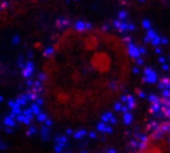 Una micrografía tomada con un aumento de 400x muestra el interior de una célula ósea MG-63. Pequeñas esferas microplásticas de poliestireno aparecen dentro del citoplasma y están resaltadas en azul. El núcleo celular se muestra en rojo. Crédito de la imagen: Mariana Cassani de Oliveira/LEMON/FCM-UNICAMP