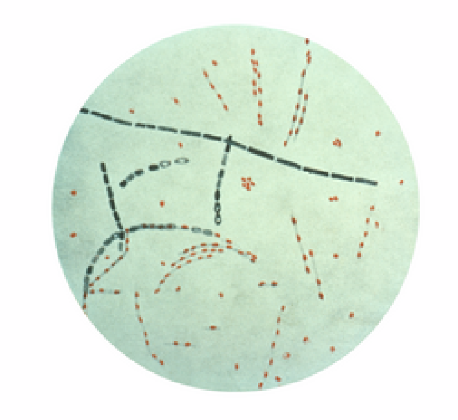 Photomicrograph of Bacillus anthracis from an agar culture demonstrating spores; Fuchsin-methylene blue spore stain. Image credit: CDC-MarcoTolo