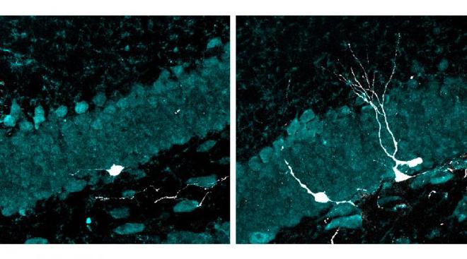 Left: in white, a neuron with very incipient dendrites is seen in an aging brain. Right: after multisensory stimulation, an increase in the number of neurons and greater dendritic complexity are observed. Image credit: Fundación Instituto Leloir