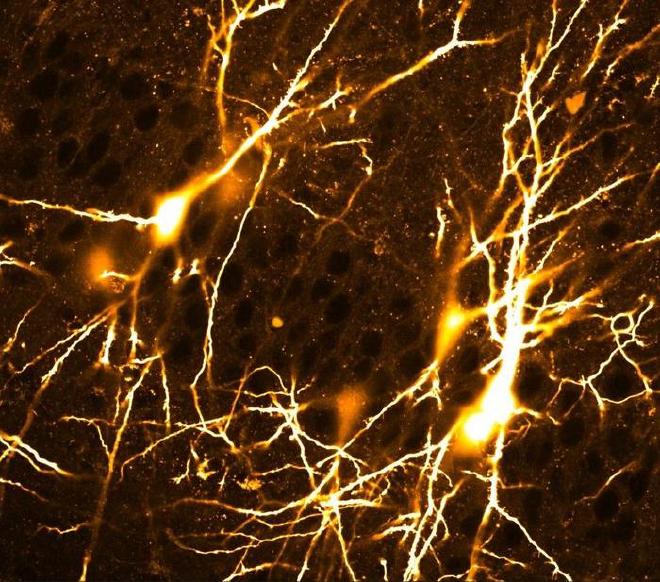 Captura de pantalla de vídeo: Red de neuronas piramidales CA3 interconectadas en el hipocampo del ratón: En ratones jóvenes, la red CA3 es muy densa y las conexiones parecen aleatorias (amarillas). Crédito de la imagen: Jake Watson / ISTA