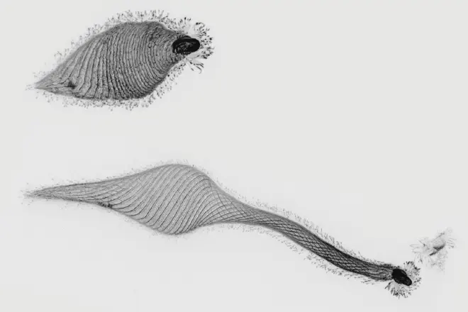 Snapshots of Lacrymaria olor contracted and elongated. | Prakash Lab